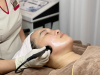 RF Lift Sculpt - Nâng cơ, săn chắc, định hình đường nét gương mặt 